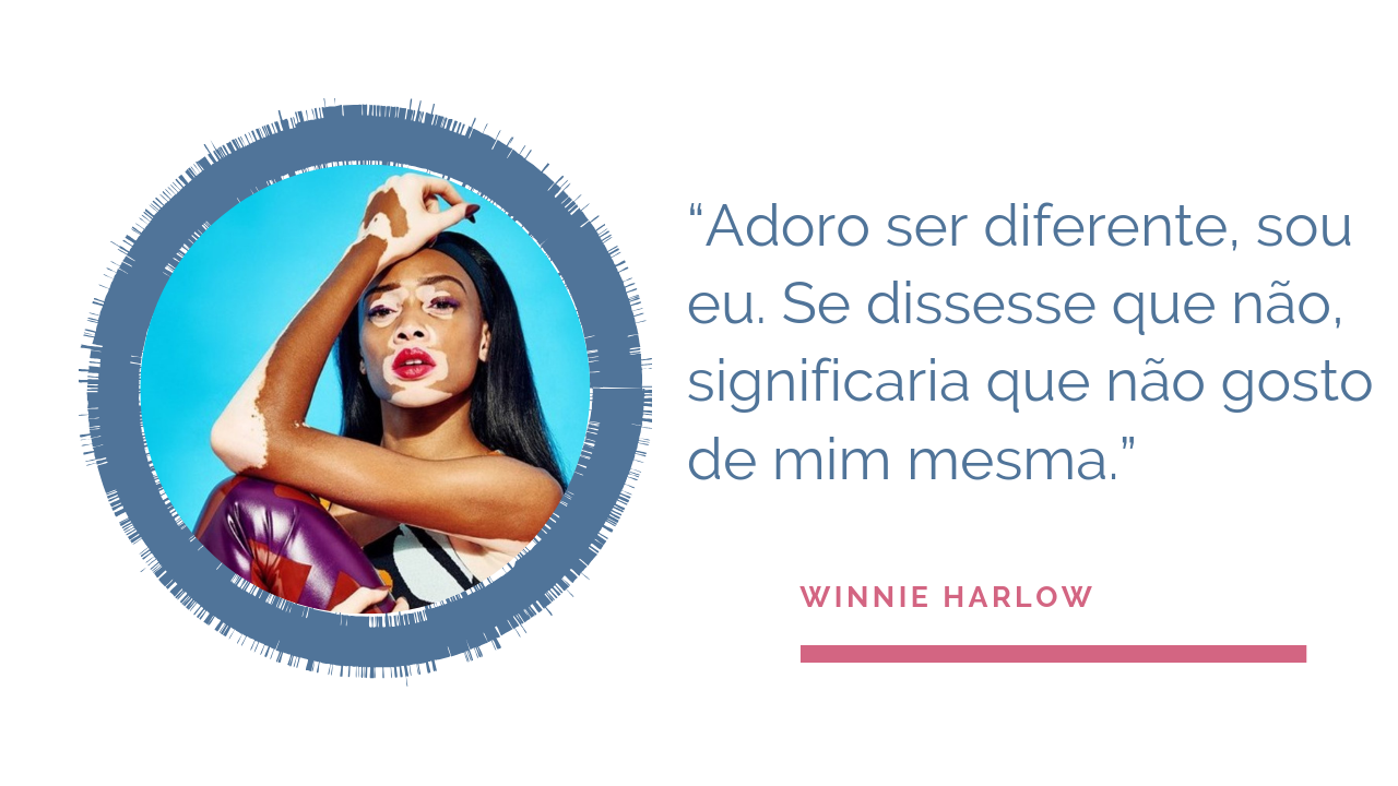 Winnie Harlow